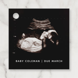 Pregnancy Baby Sonogram Ultrasound Photo Favour Tags