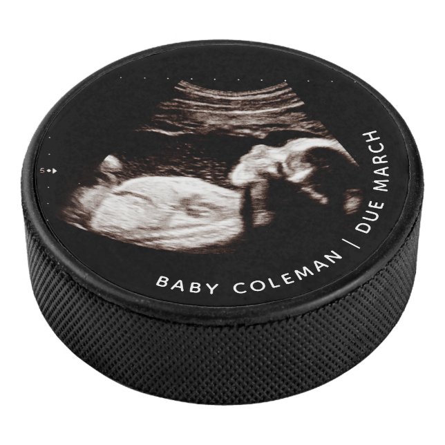 Pregnancy Baby Sonogram Ultrasound Photo Hockey Puck (3/4)