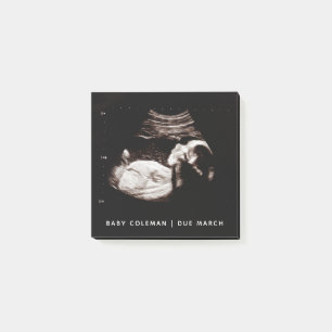 Pregnancy Baby Sonogram Ultrasound Photo Post-it Notes