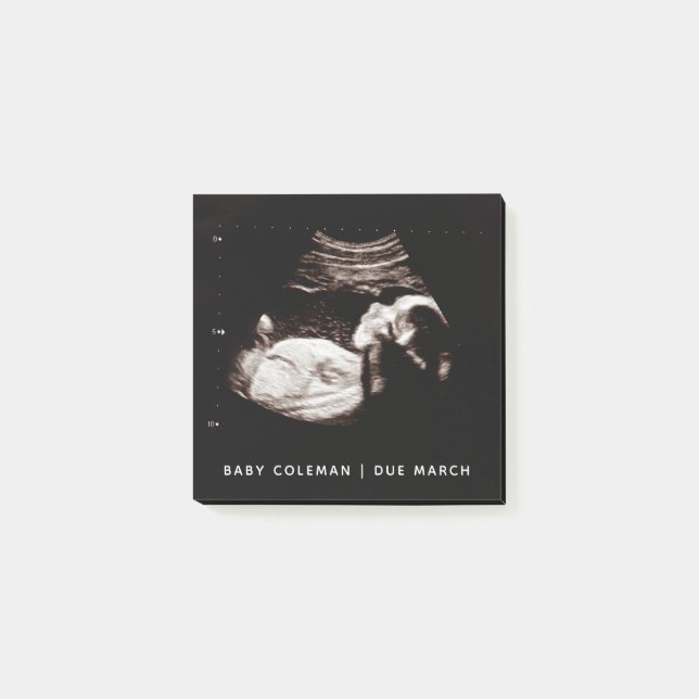 Pregnancy Baby Sonogram Ultrasound Photo Post-it Notes (Front)
