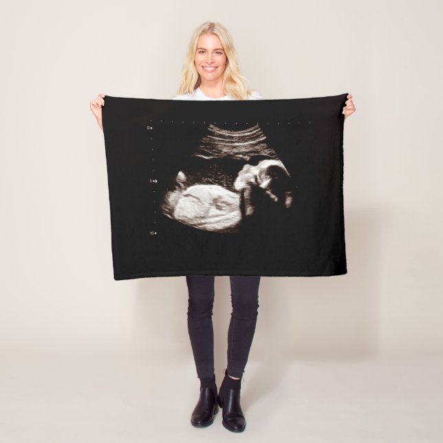 Pregnancy Keepsake Baby Ultrasound Sonogram Photo Fleece Blanket (In Situ)