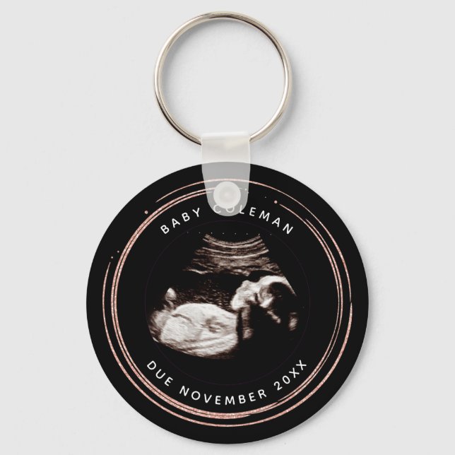 Pregnancy Pink Glitter Sonogram Ultrasound Photo Key Ring (Front)