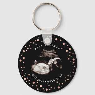 Pregnancy Pink Glitter Sonogram Ultrasound Photo Key Ring