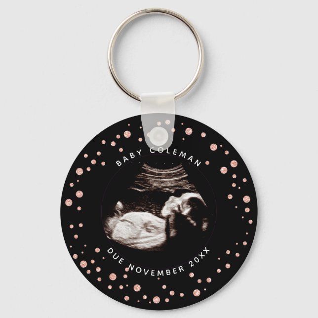 Pregnancy Pink Glitter Sonogram Ultrasound Photo Key Ring (Front)