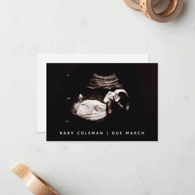 Pregnancy Reveal Baby Ultrasound Sonogram Photo Card (Front/Back In Situ)