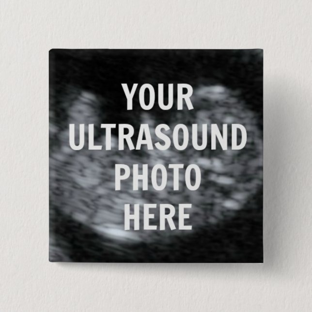 Pregnancy Ultrasound Keepsake 15 Cm Square Badge (Front)