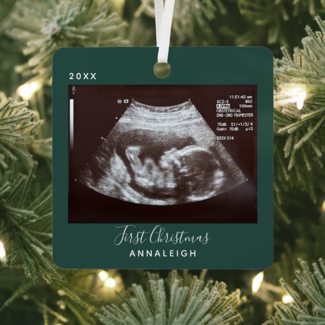 Pregnancy Ultrasound Photo First Christmas Holiday Metal Tree Decoration (Insitu)