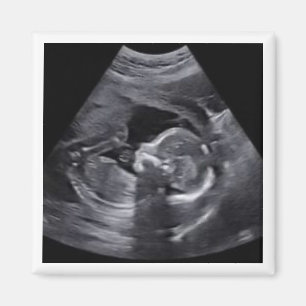Pregnant Sonogram Photo Timeless Keepsake fun Magnet