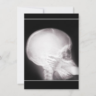 Prescription Invite w/Foot In Mouth X-ray