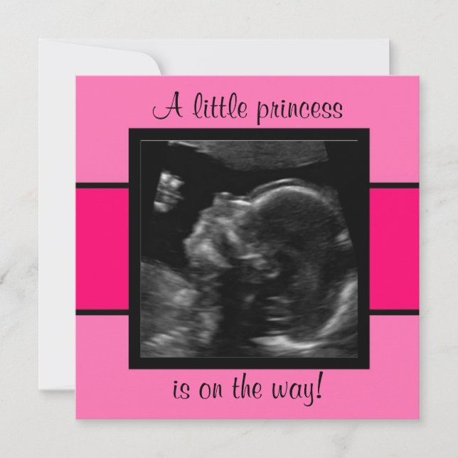 Princess Baby Customised Ultrasound Photo Template (Front)