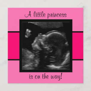 Princess Baby Customised Ultrasound Photo Template