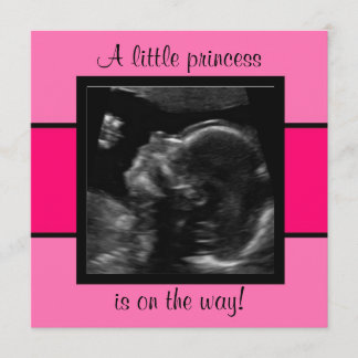 Princess Baby Customised Ultrasound Photo Template
