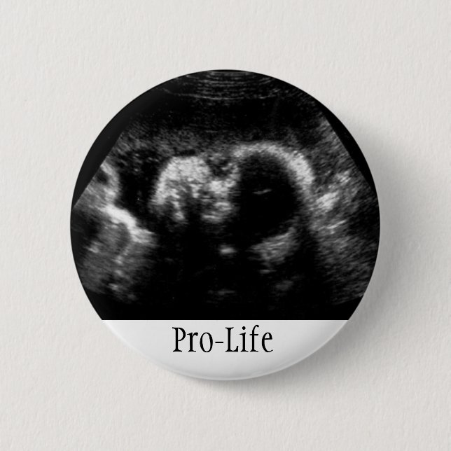 Pro-Life 6 Cm Round Badge (Front)