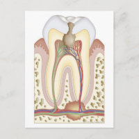 Pulp and Root Abscess