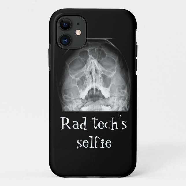 Rad tech selfies Case-Mate iPhone case (Back)