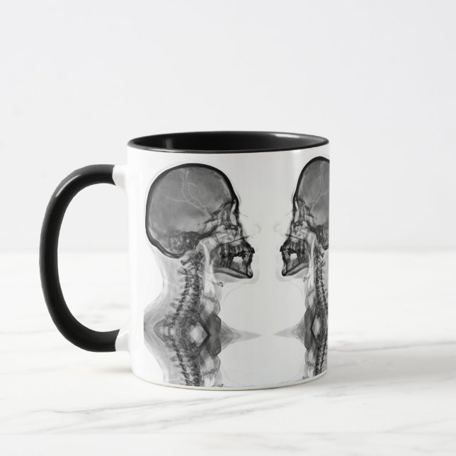 Radiological mug (Left)