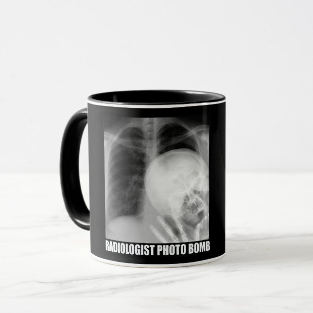 RADIOLOGIST PHOTO BOMB MUG (Front Left)