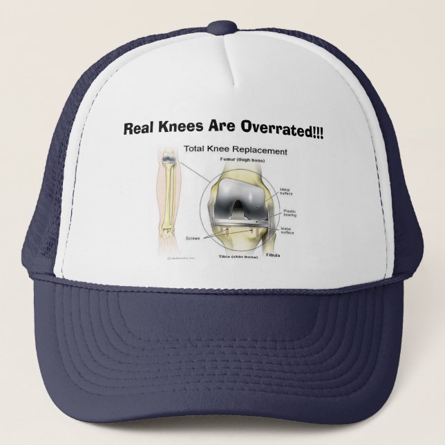 Real Knees Are Overrated!!! Trucker Hat (Front)