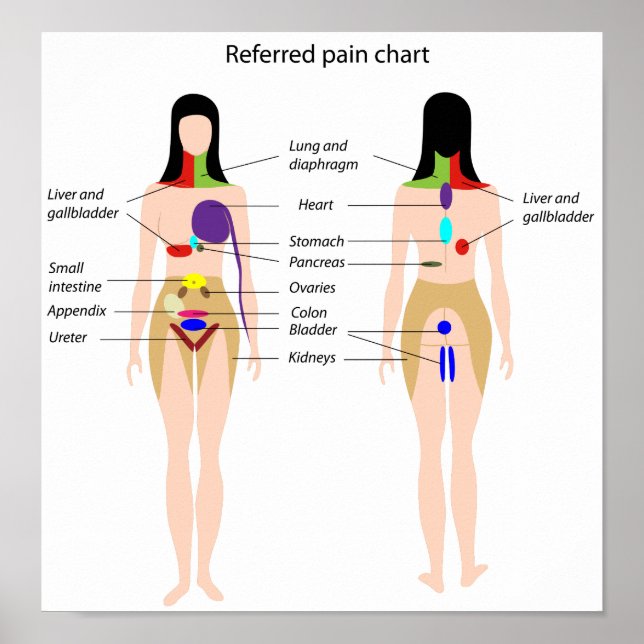 Referred pain chart Poster (Front)