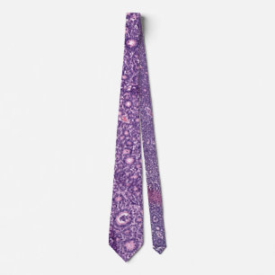 Retinoblastoma Tie