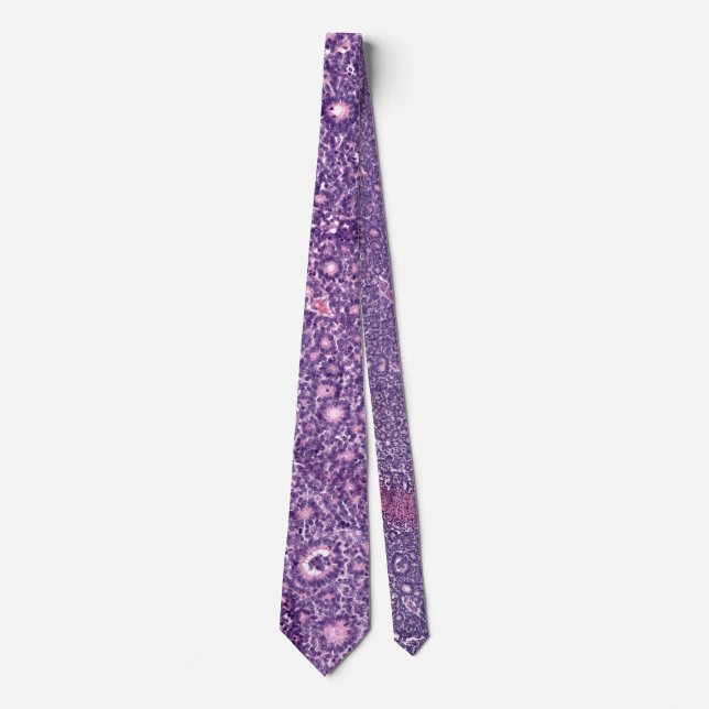 Retinoblastoma Tie (Front)