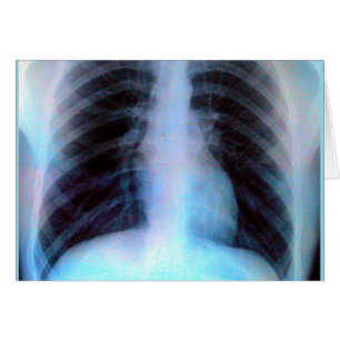 Ribcage Xray Skeleton