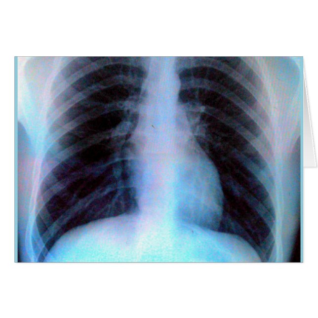 Ribcage Xray Skeleton (Front Horizontal)
