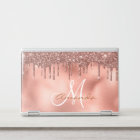 Rose Gold Glitter Drips Personalised Monogram