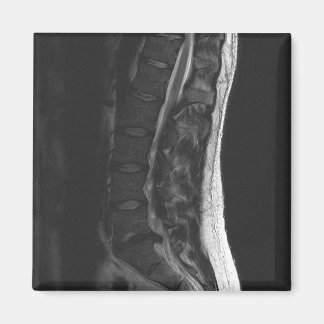 Ruptured Disc Magnet