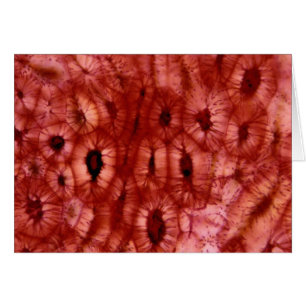 Sclerenchyma Cells from a Cherry Pit