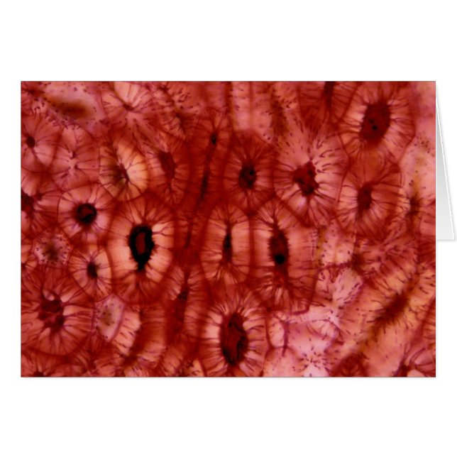 Sclerenchyma Cells from a Cherry Pit (Front Horizontal)