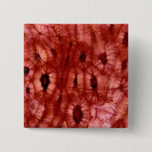 Sclerenchyma Cells from a Cherry Pit 15 Cm Square Badge