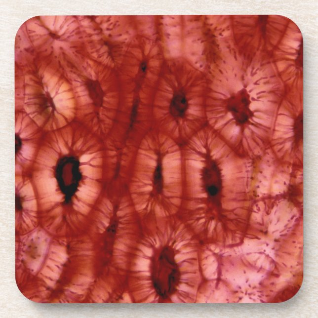 Sclerenchyma Cells from a Cherry Pit Coaster (Front)