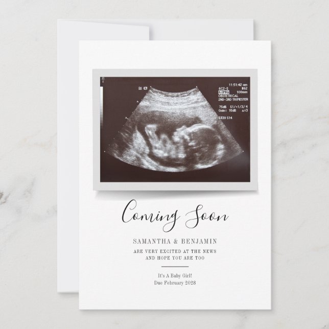 Script Sonogram Coming Soon Pregnancy Announcement (Front)