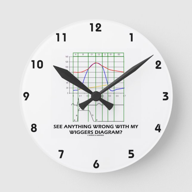 See Anything Wrong With My Wiggers Diagram? Round Clock (Front)