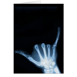 Shaka Sign X-Ray (Hang Loose)