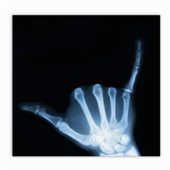 Shaka Sign X-Ray (Hang Loose) Standing Photo Sculpture (Front)