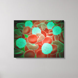 Sickle Cell Anaemia With Red Blood Cells Canvas Print