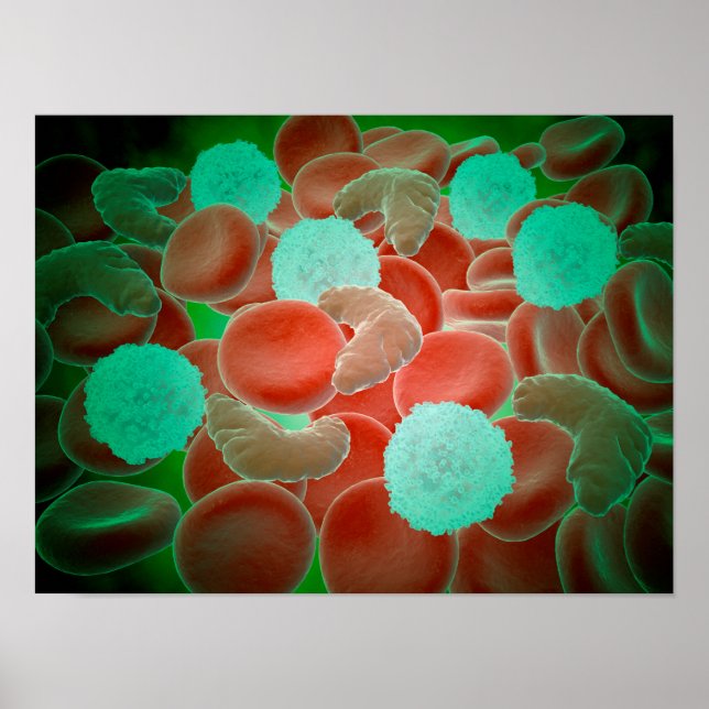 Sickle Cell Anaemia With Red Blood Cells Poster (Front)