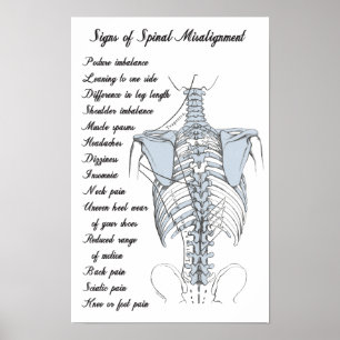 Signs of Spinal Misalignment Chiropractic
