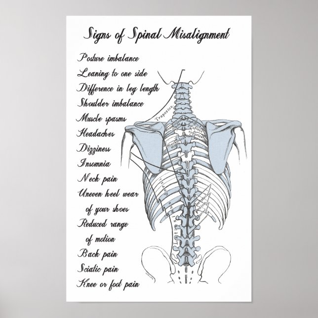 Signs of Spinal Misalignment Chiropractic (Front)