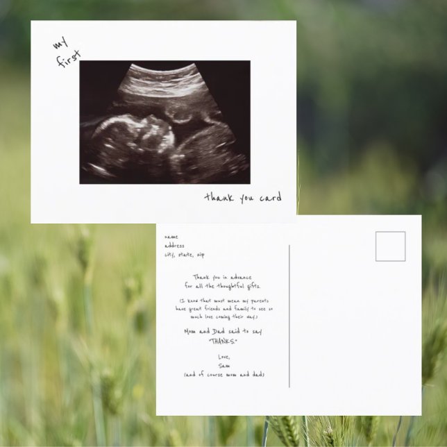 Simple Funny Ultrasound Baby Shower Thank You Postcard (Creator Uploaded)
