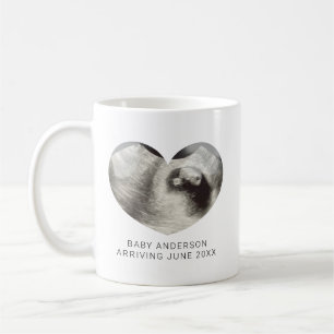 Simple Heart Ultrasound Pregnancy Reveal  Coffee Mug