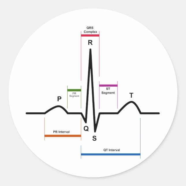 Sinus Rhythm in an Electrocardiogram ECG Diagram Classic Round Sticker (Front)