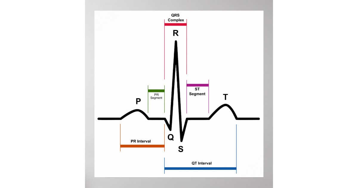 Sinus R1 Sinus Rhythm in an Electrocardiogram ECG Diagram Poster | Zazzle