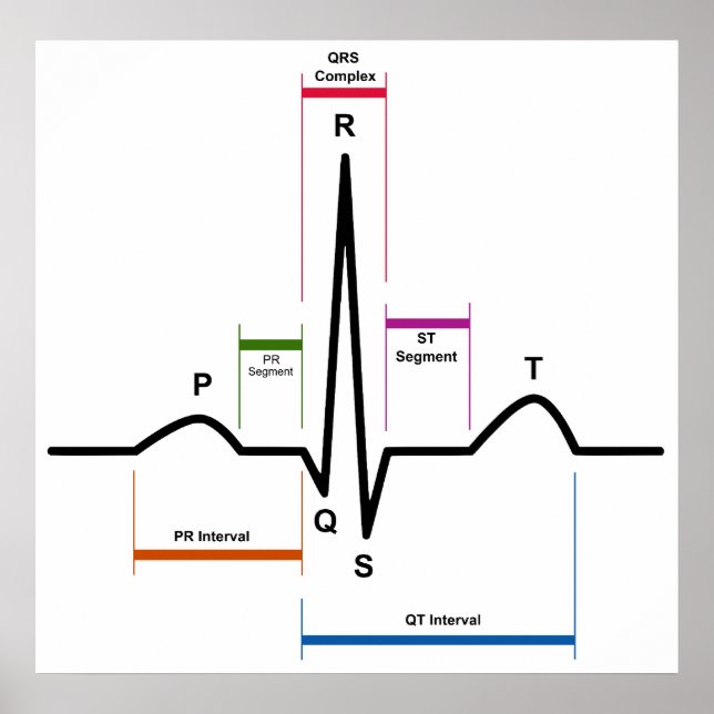 Sinus Rhythm in an Electrocardiogram ECG Diagram Poster (Front)