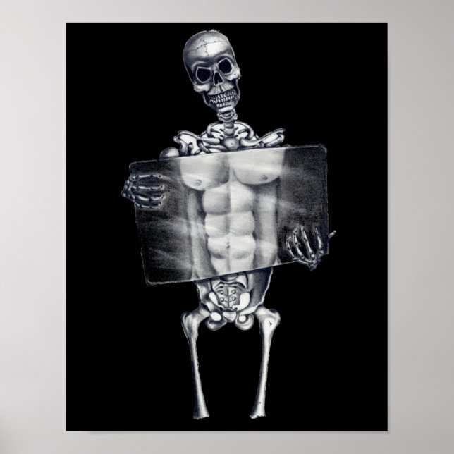 Skeleton Chest Xray Posters (Front)