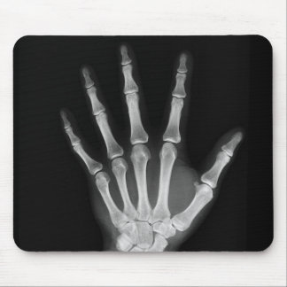 skeleton hand mouse pad