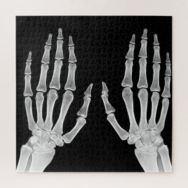 Skeleton Hands Xray Picture Human Anatomy photo Jigsaw Puzzle (Vertical)