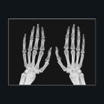 Skeleton Hands Xray Picture Human Anatomy photo Postcard<br><div class="desc">Skeleton Hands Xray Picture Human Anatomy photo</div>